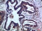 IL-17F Polyclonal Antibody