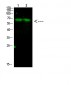 Parafibromin Polyclonal Antibody