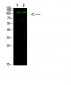 GLI-1 Polyclonal Antibody