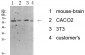 Tyrosine Hydroxylase Polyclonal Antibody