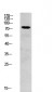 SYK antibody