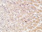 TIE2 Polyclonal Antibody