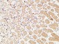 TIE2 Polyclonal Antibody