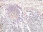 TIE2 Polyclonal Antibody