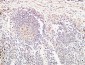 TIE2 Polyclonal Antibody