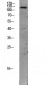 TIE2 Polyclonal Antibody