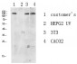 DDR1 antibody