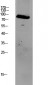 GRK2 antibody