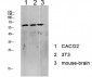 Tip60 Polyclonal Antibody
