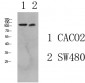 Collagen I Polyclonal Antibody