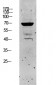 Keratin 5 Polyclonal Antibody