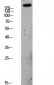 PDGFR α Polyclonal Antibody