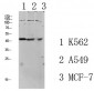 TGF β1 Polyclonal Antibody
