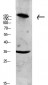 Collagen XI α1 Polyclonal Antibody
