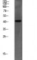 PEX14 Polyclonal Antibody