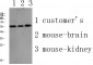 PLD4 Polyclonal Antibody