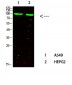 Bcl-6 Polyclonal Antibody