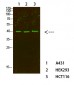 C/EBP β Polyclonal Antibody