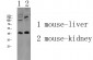 AGTR1 Polyclonal Antibody