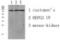 LSHR Polyclonal Antibody