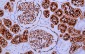 CD10 Antibody