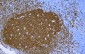 CD20 Antibody