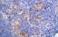 CD30 Antibody