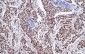 ER-Beta Antibody