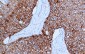 HER2 Antibody