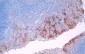 PD-L1 Antibody