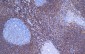 bcl-2 Antibody