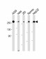 FASN Antibody (Center)