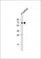 HHLA2 Antibody (N-term)