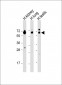 HHLA2 Antibody (N-term)
