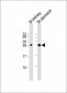 PSCA Antibody (Center)