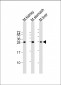 PSCA Antibody (Center)