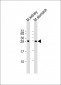 PSCA Antibody (Center)