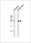 PSCA Antibody (Center)