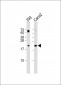 RAC2 Antibody (C-term)