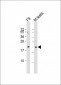 VHL Antibody (N-term)