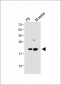 VHL Antibody (N-term)