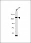 PDGFRA Antibody (Y720)