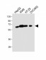 CYP3A4 Antibody (Center)