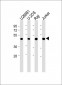 ETV6 Antibody (N-term)