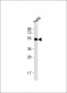 HtrA1 Antibody (N-term)