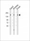 ATP7B Antibody (C-term)