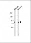 DCAMKL1 Antibody (C-term)