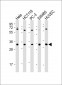 TNFRSF6B Antibody (N-term)