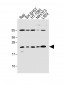 Bax Antibody (BH3 Domain Specific)