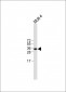 TRBC1 Antibody (Center)